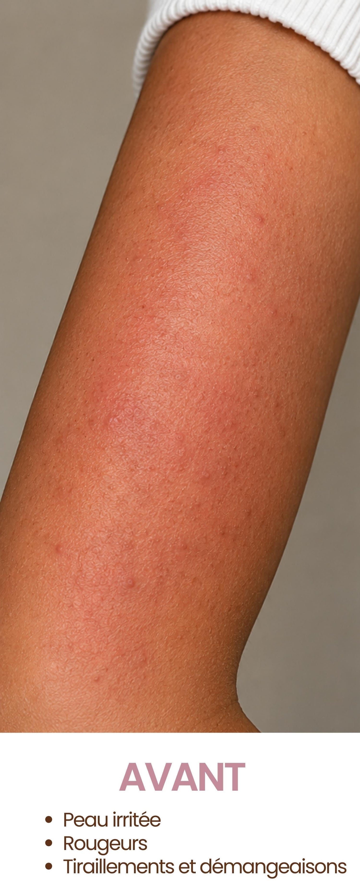 Peau sensible, eczema, chantilly de karité les douceurs de NL