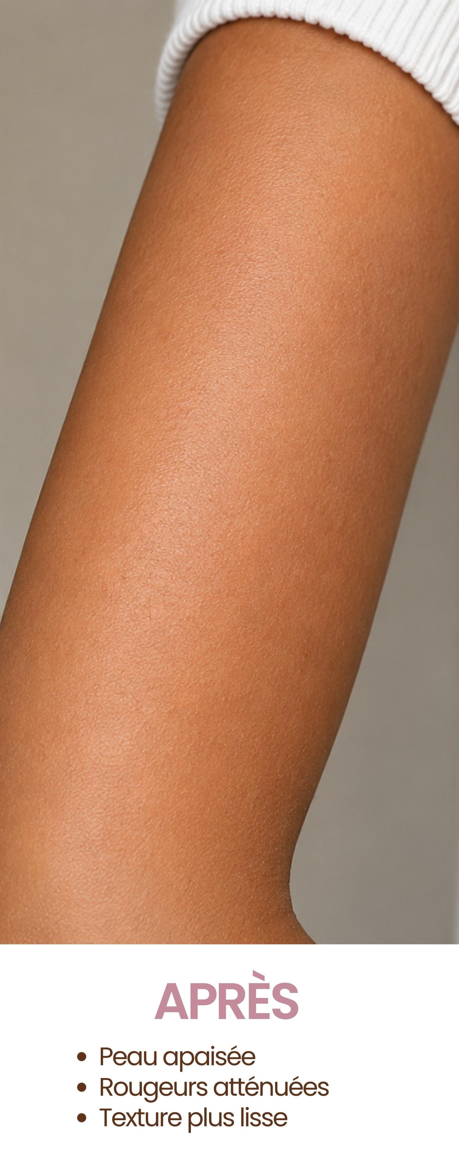 Peau sensible, eczema, chantilly de karité les douceurs de NL, avant après